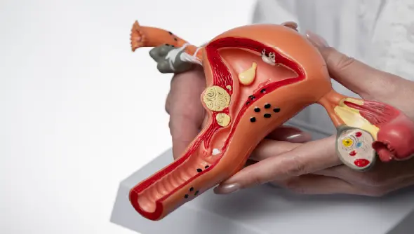 An image of the ovary, highlighting women's reproductive health