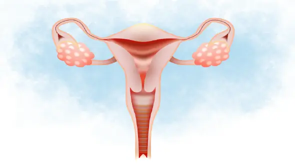 Cervical cancer treatment options, including surgery and chemotherapy
