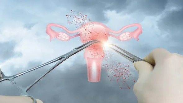 Expert cervical cancer surgery with radical hysterectomy and laparoscopic options for quicker recovery