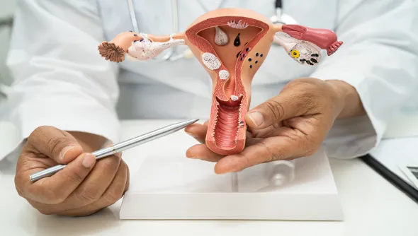 Doctor explaining uterine cancer surgery, discussing treatment options